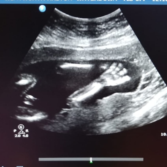 Meet your Posher, Rhealyn - Picture 1 of 1